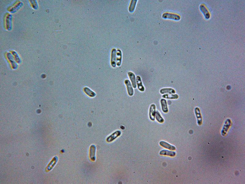 Un corticale da identificare